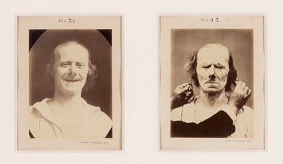Lot 3005 - Four plates by Duchenne de Boulogne
