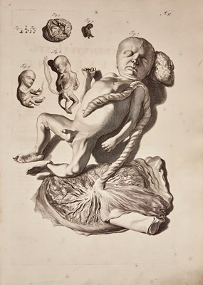 Lot 36 - Bidloo's anatomy in the vernacular